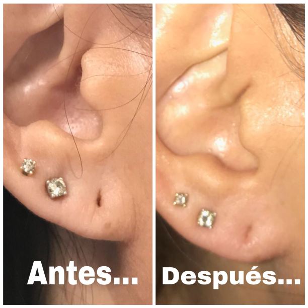 6DB70B96-F30C-4124-8D71-D7A308D65D1C